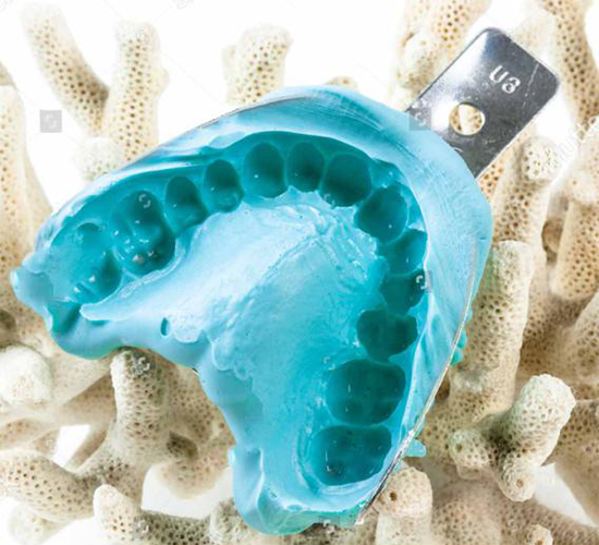 Materiales de impresión de alginato dental Materiales de impresión de alginato dental