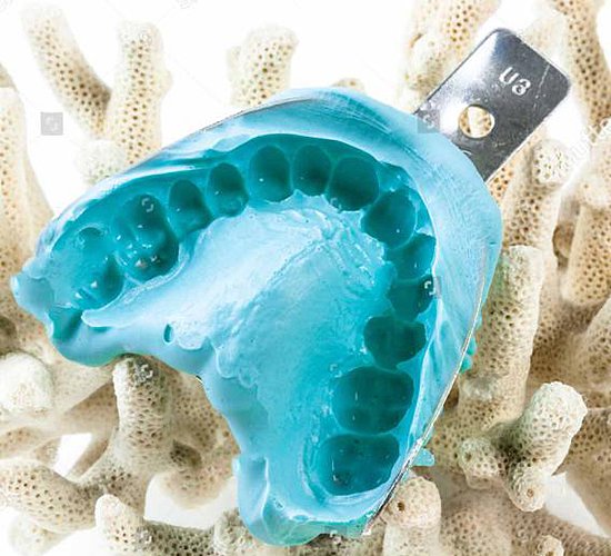 Materiales de impresión de alginato dental